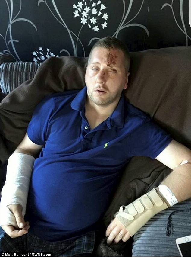 Following this, he was off work for three and a half months and still suffers 'constant pain' in his right hand