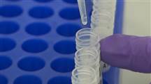 Theranos blood-testing lab poses 'immediate jeopardy to patient health'
