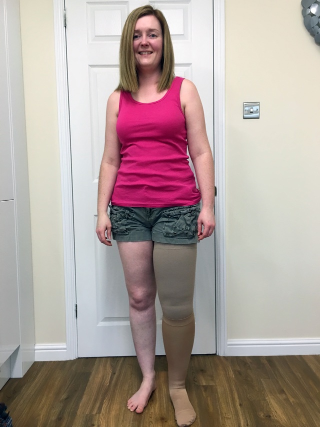 Woman's leg doubles in size after honeymoon infection